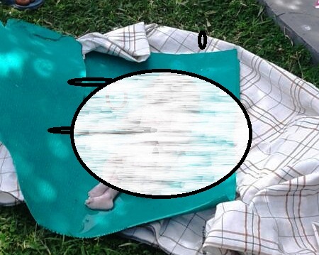 Mayat Bayi di Taman Mattirotasi, Begini Hasil Visum Dokter