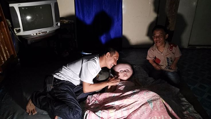 Bayi Derita Hidrosefalus, Butuh Bantuan Dermawan