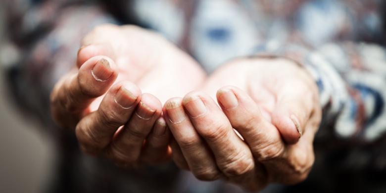 Potret Kemiskinan; Dapur Roboh, Janda Tua Harapkan Bedah Rumah Potret Kemiskinan; Dapur Roboh, Janda Tua Harapkan Bedah Rumah