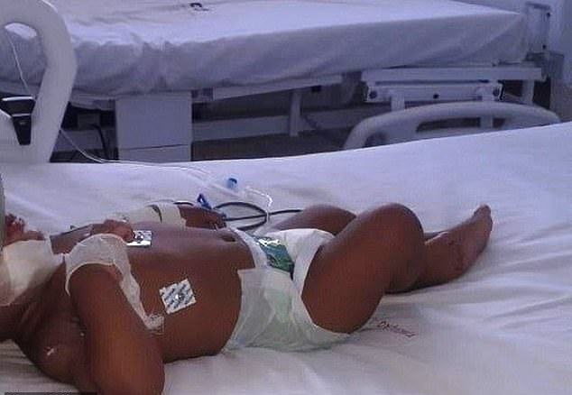 Bayi Enam Bulan Ini Menderita Luka Bakar Serius Akibat Setrum Listrik