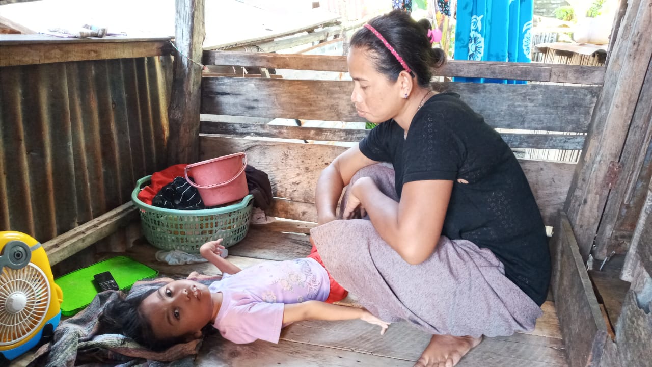 Adelia, Bocah Penderita Lumpuh Layu di Barru Butuh Kursi Roda