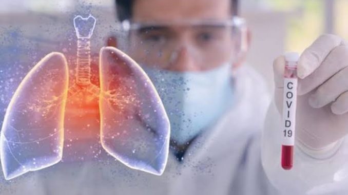 Karyawati Bank di Parepare Positif Covid-19, Seluruh Teman Kantornya Jalani Rapid Test