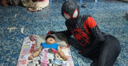 Butuh Uluran Tangan, Bayi di Pinrang Ini Derita Benjolan Tumbuh di Kepala