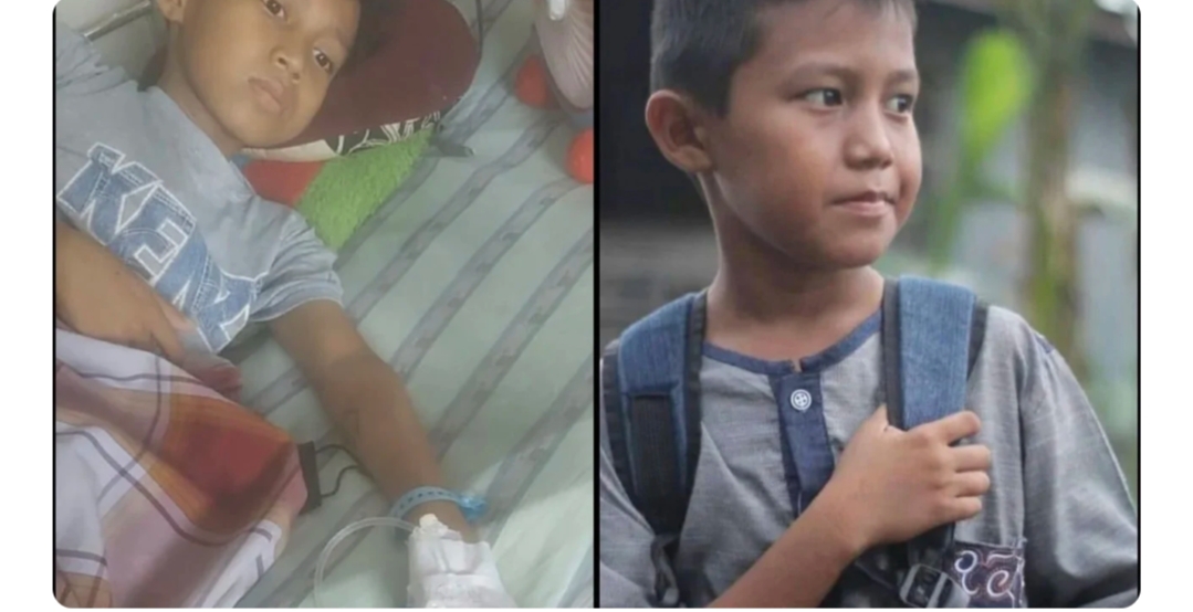 Ikhsanul, Bocah 11 Tahun Asal Parepare Penderita Tumor Recti Butuh Uluran Tangan