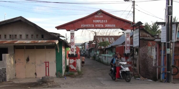 Melawan Stigma Kusta di Kampung Jongaya Makassar