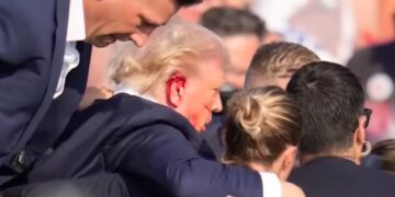 Luka Tembak Ditelinga, Donald Trump Tak Mau Penembak Putuskan Rencananya